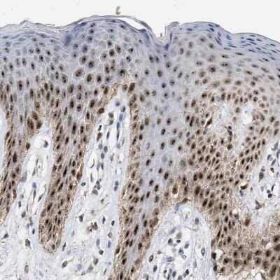 Immunohistochemistry-Paraffin: ELAC2 Antibody [NBP1-84620]