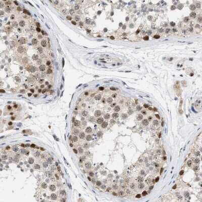 Immunohistochemistry-Paraffin: ELAC2 Antibody [NBP1-84620]