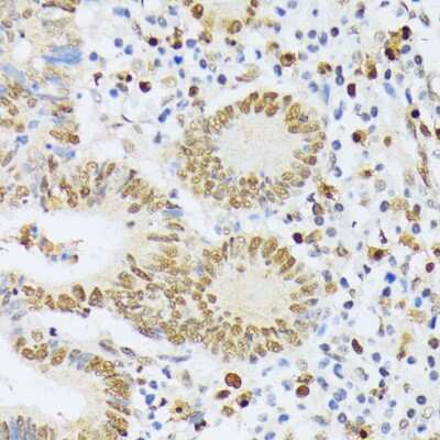 Immunohistochemistry-Paraffin: ELAC2 Antibody - BSA Free [NBP3-04612]