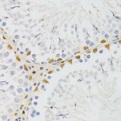 Immunohistochemistry-Paraffin: ELAC2 Antibody - BSA Free [NBP3-04612]