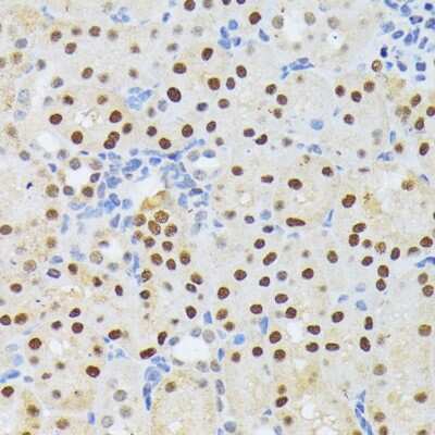 Immunohistochemistry-Paraffin: ELAC2 Antibody - BSA Free [NBP3-04612]