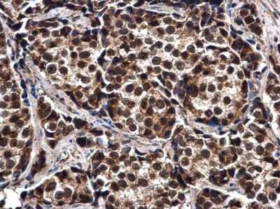 Immunohistochemistry-Paraffin: ELAC2 Antibody [NBP3-12934]
