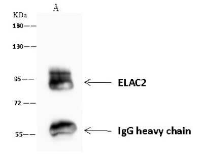 Immunoprecipitation: ELAC2 Antibody [NBP2-97772]