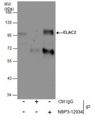 Immunoprecipitation: ELAC2 Antibody [NBP3-12934]