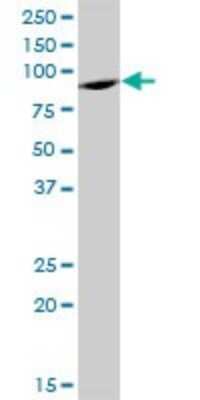 Western Blot: ELAC2 Antibody [H00060528-B01P]