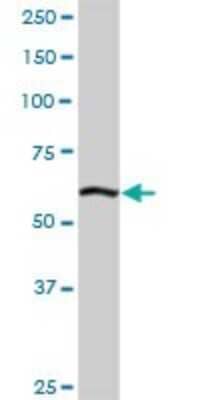 Western Blot: ELAC2 Antibody [H00060528-D01P]