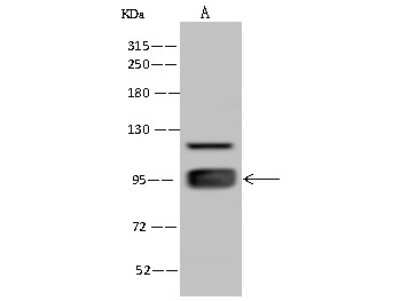 Western Blot: ELAC2 Antibody [NBP2-97772]