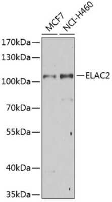 Western Blot: ELAC2 AntibodyBSA Free [NBP3-04612]