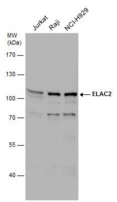 Western Blot: ELAC2 Antibody [NBP3-12934]