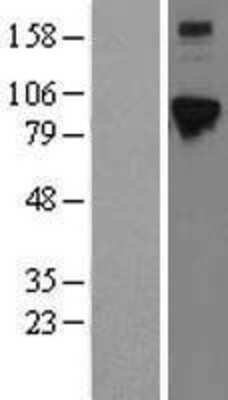 Western Blot: ELAC2 Overexpression Lysate [NBL1-10223]