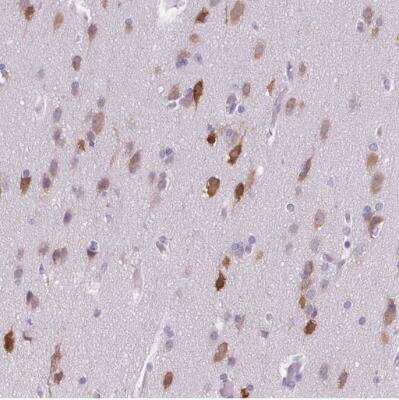 Immunohistochemistry-Paraffin: ELAVL2 Antibody [NBP2-38012]