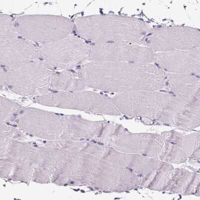 Immunohistochemistry-Paraffin: ELAVL2 Antibody [NBP2-38012]