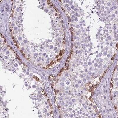Immunohistochemistry-Paraffin: ELAVL2 Antibody [NBP2-38012]