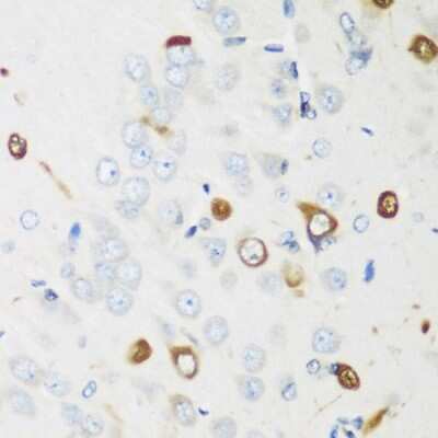 Immunohistochemistry-Paraffin: ELAVL2 Antibody - BSA Free [NBP3-03894]