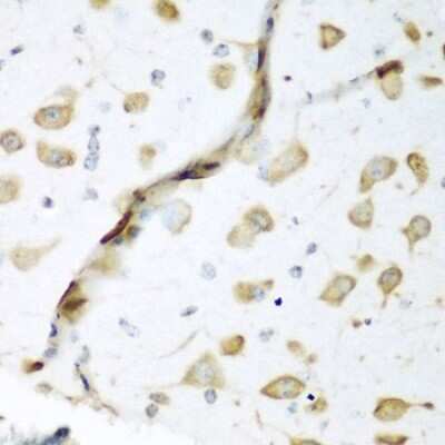 Immunohistochemistry-Paraffin: ELAVL2 Antibody - BSA Free [NBP3-03894]