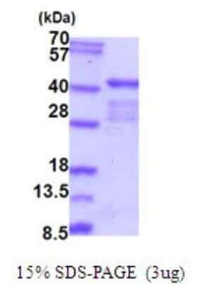 SDS-PAGE: Recombinant Human ELAVL2 His Protein [NBP2-51932]