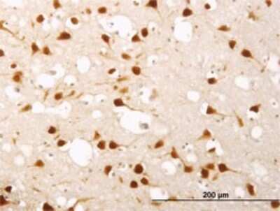 Immunohistochemistry-Paraffin: ELAVL4 Antibody (6B9) [H00001996-M01]