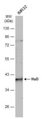 Western Blot: ELAVL4 Antibody [NBP3-13359]