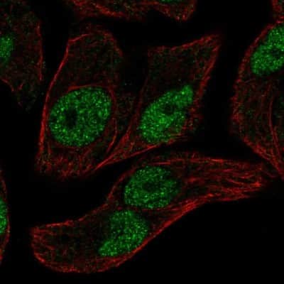Immunocytochemistry/ Immunofluorescence: ELF2 Antibody [NBP2-49646]