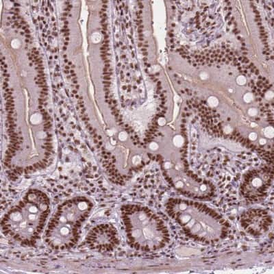 Immunohistochemistry: ELF2 Antibody [NBP2-49646]
