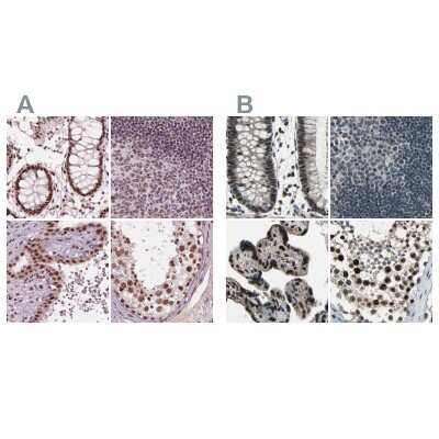 Immunohistochemistry-Paraffin: ELF2 Antibody [NBP2-49646]