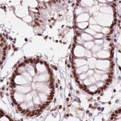 Immunohistochemistry-Paraffin: ELF2 Antibody [NBP2-49646]