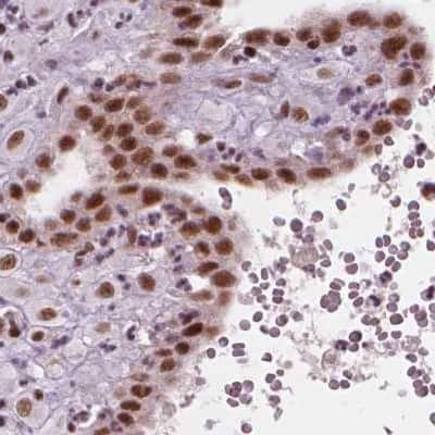 Immunohistochemistry-Paraffin: ELF2 Antibody [NBP2-49646]