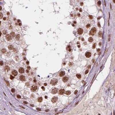 Immunohistochemistry-Paraffin: ELF2 Antibody [NBP2-49646]