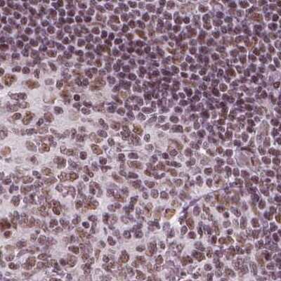 Immunohistochemistry-Paraffin: ELF2 Antibody [NBP2-49646]