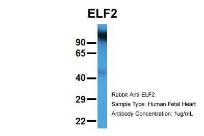 Western Blot: ELF2 Antibody [NBP2-87348]