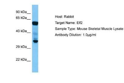 Western Blot: ELF2 Antibody [NBP2-87348]