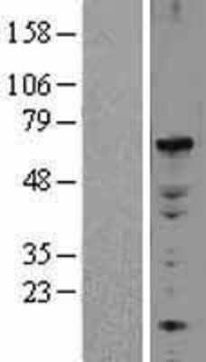 Western Blot: ELF2 Overexpression Lysate [NBL1-10228]