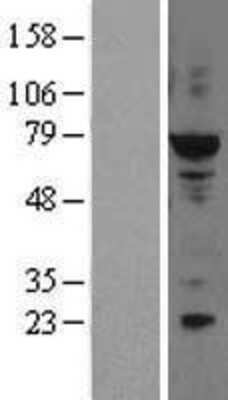 Western Blot: ELF2 Overexpression Lysate [NBL1-10229]