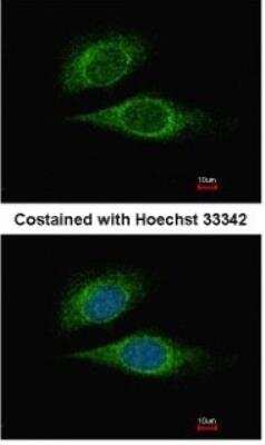 Immunocytochemistry/ Immunofluorescence: ELF3/ESE-1 Antibody [NBP1-30873]