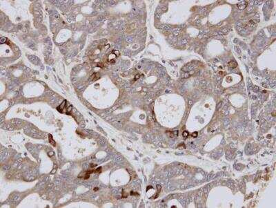 Immunohistochemistry-Paraffin: ELF3/ESE-1 Antibody [NBP1-30873]