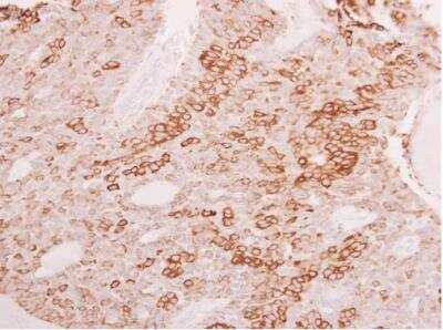 Immunohistochemistry-Paraffin: ELF3/ESE-1 Antibody [NBP1-30873]