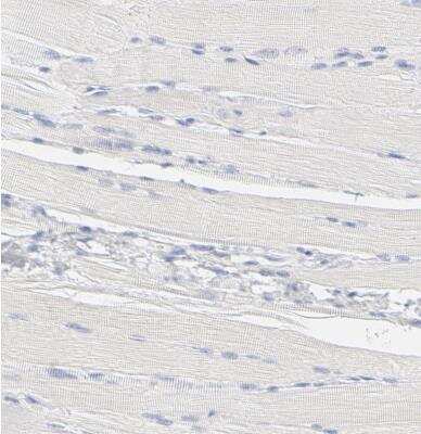 Immunohistochemistry-Paraffin: ELF3/ESE-1 Antibody [NBP1-87945]