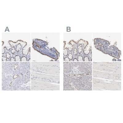 Immunohistochemistry-Paraffin: ELF3/ESE-1 Antibody [NBP1-87945]