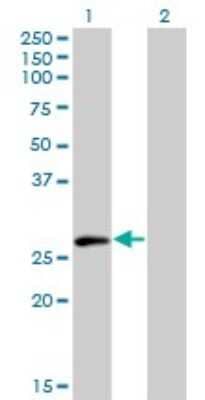 Western Blot: ELF5 Antibody (3D10) [H00002001-M01]