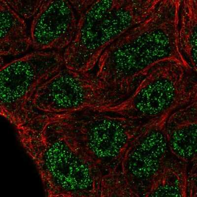 Immunocytochemistry/ Immunofluorescence: ELF5 Antibody [NBP2-57358]