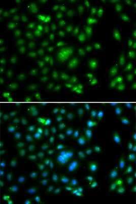 Immunocytochemistry/ Immunofluorescence: ELF5 Antibody - Azide and BSA Free [NBP3-04468]