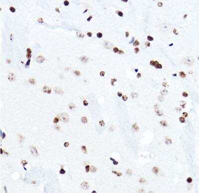 Immunohistochemistry-Paraffin: ELF5 Antibody - Azide and BSA Free [NBP3-04468]