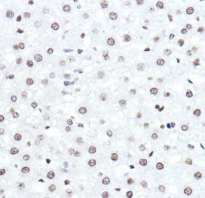 Immunohistochemistry-Paraffin: ELF5 Antibody - Azide and BSA Free [NBP3-04468]