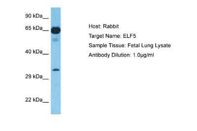 Western Blot: ELF5 Antibody [NBP2-87352]