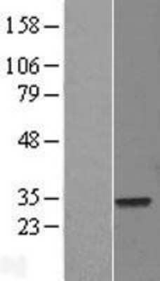 Western Blot: ELF5 Overexpression Lysate [NBL1-10232]