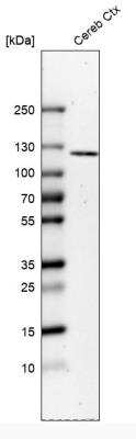 Western Blot: ELFN2 Antibody [NBP1-90569]