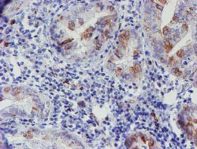 Immunohistochemistry-Paraffin: ELK3 Antibody (OTI1H3) [NBP2-01264]