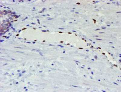 Immunohistochemistry-Paraffin: ELK3 Antibody (OTI1H3) [NBP2-01264]
