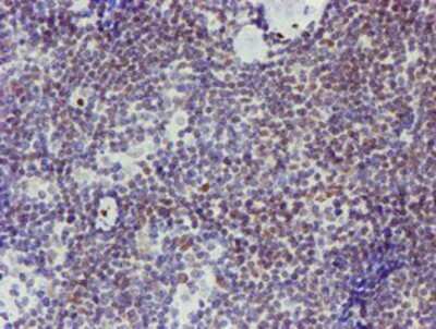 Immunohistochemistry-Paraffin: ELK3 Antibody (OTI1H3) [NBP2-01264]