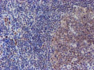 Immunohistochemistry-Paraffin: ELK3 Antibody (OTI1H3) [NBP2-01264]